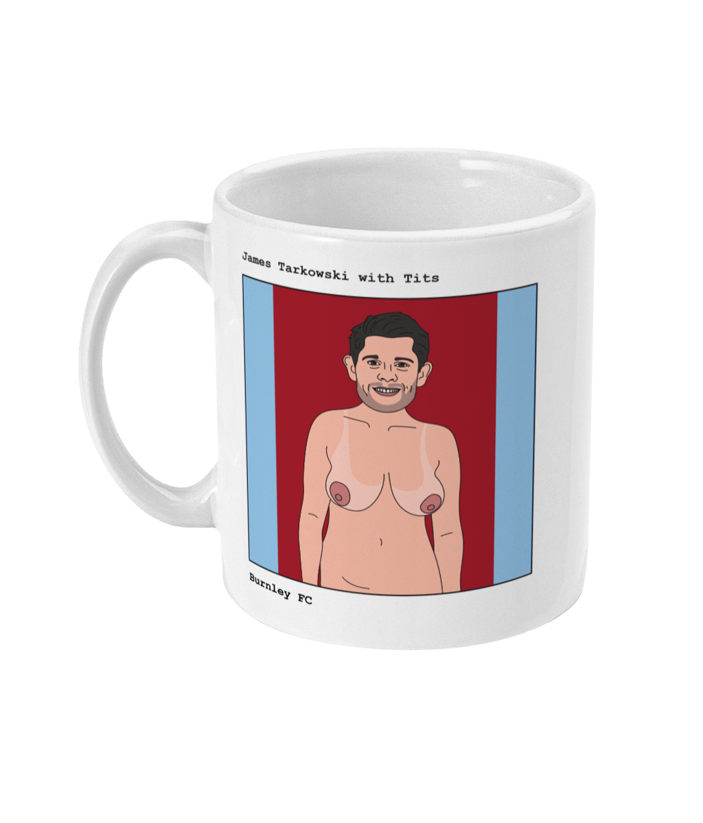 James Tarkowski with Tits